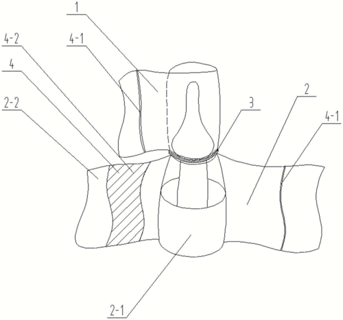 一种新型安瓿开瓶器_cn201920139930.3_知雀网