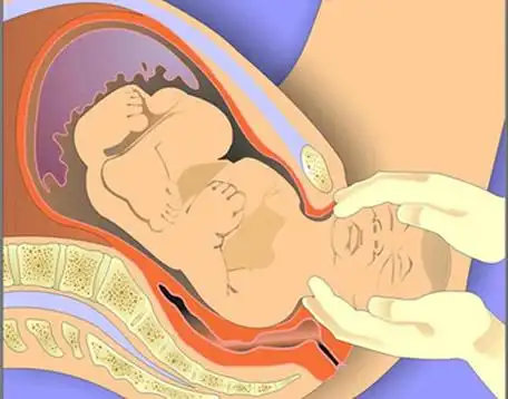 所以古人说生孩子是"过鬼门"有时因为难产或者产后大出血,许多孕妇性