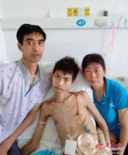 山阳16岁男孩患结核病暴瘦50斤 看着让人心疼