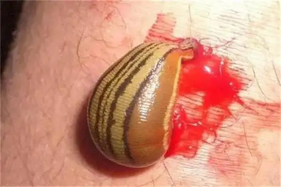 云南十大最毒虫子:蚊子数量繁多(潮湿环境适宜繁殖)