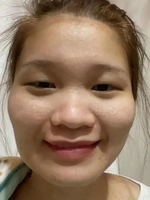 女生长得特别丑怎么办