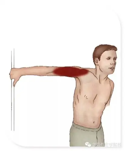 上肢肌肉拉伸 - 好大夫在线