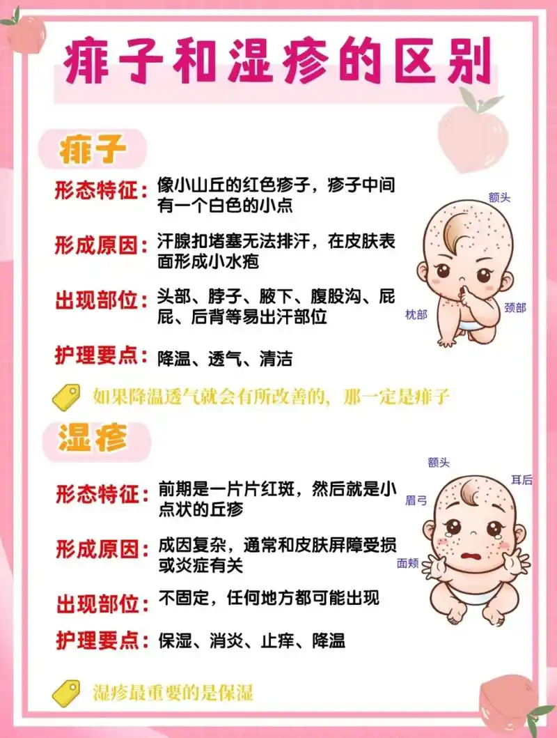 湿疹和痱子区别 新手爸妈一定要看的!