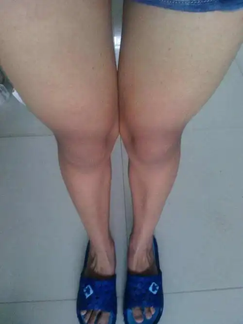 赘肉这似乎就是中年妇女的身材状况,肚子上一圈一圈的游泳圈逐渐突出