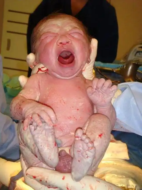 孩子刚出生简直就是恐怖片不过相信每一个妈妈应该不会嫌弃自己的孩子