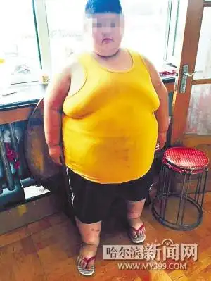 10岁男孩300斤妈妈哭求减肥良方