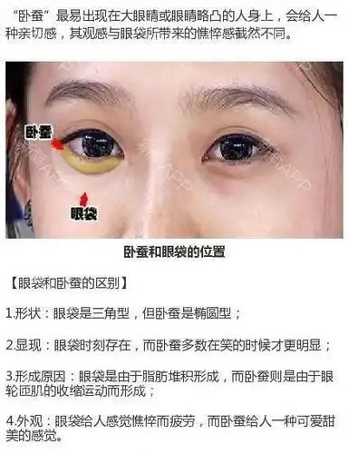 【你能区分眼袋与卧蚕的区别吗】