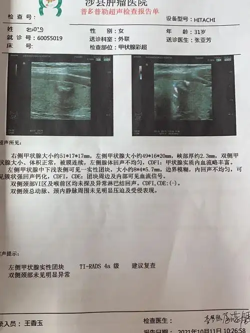 甲状腺结节多个医院超声结果,21年10月份体