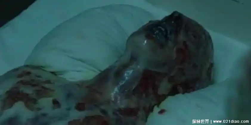 福岛的核电站引发了剧烈的核反应,相继爆炸,导致周围许多人受到核辐射