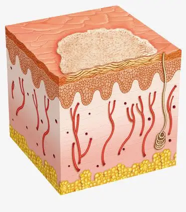 手绘/卡通 卡通元素 > 受损的皮肤 收藏 [声明] 觅元素所有素材为用户