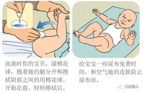 下面接着便盆,上面用清洁的小壶或者瓶子,装满水,轻轻的从上向下冲洗.