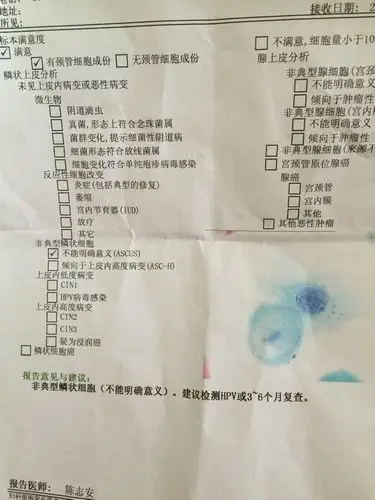 非典型鳞状细胞不明确意义是什么意思?有没有什么问题?46岁