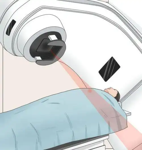 而且由于现代放疗影像引导的技术,放射治疗导致的副作用非常小