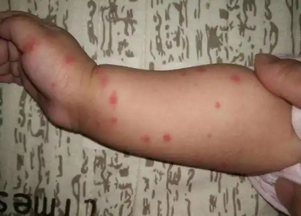 床上放点"它",螨虫自动"消失了"