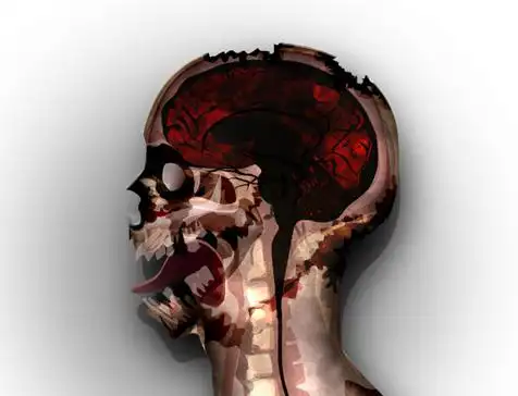 瘟疫公司necroa僵尸病毒通过详解