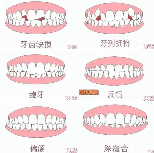 能利用的牙齿为28颗每个人本身拥有32颗恒牙诊所小贴士■上海市口腔