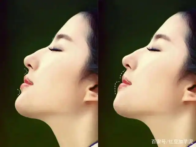 你的颌面正常吗?