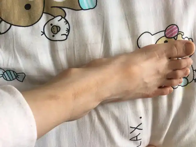 孩子7岁,身高128厘米,体重44斤,体型偏瘦,最近发现脚上的那个骨头有点