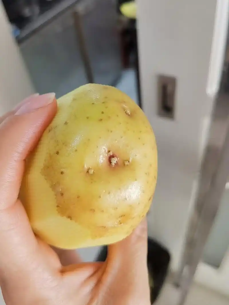 我之前看了个新闻说有小孩吃了发芽的土豆肾脏衰竭了,我就挺害怕的.