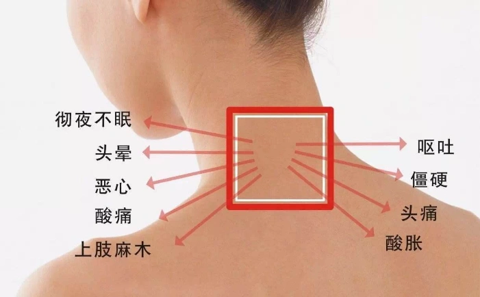 颈椎病的症状图片