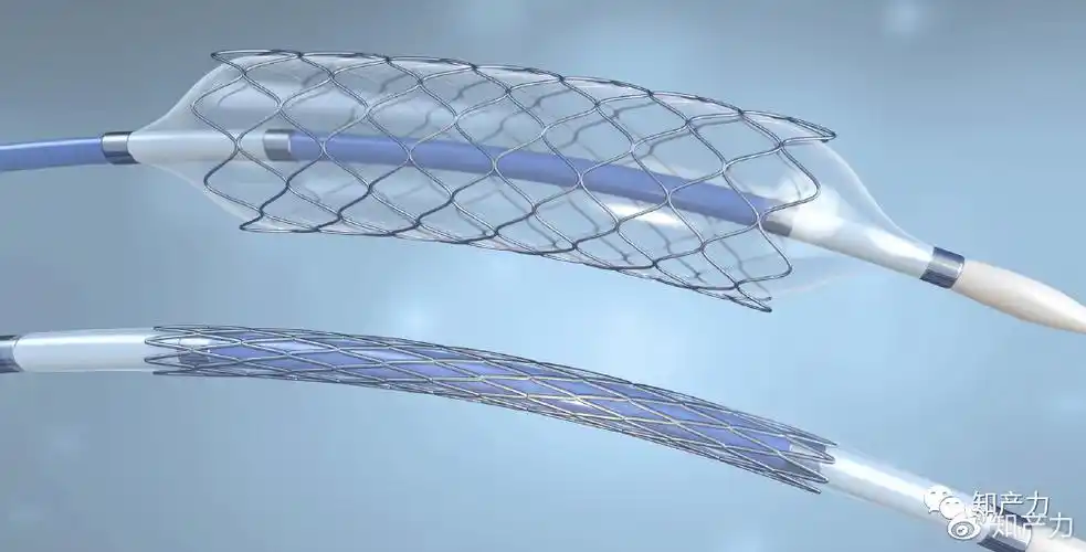 心脏支架何来暴利