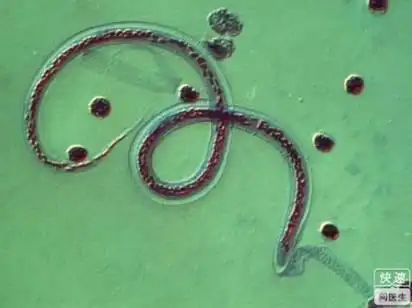 蛲虫寿命一般20至30天,如能避免重复感染,即使不治疗也能自行痊愈