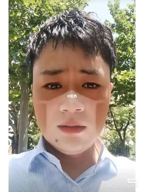 都晒成这样了戴口罩还是不戴口罩