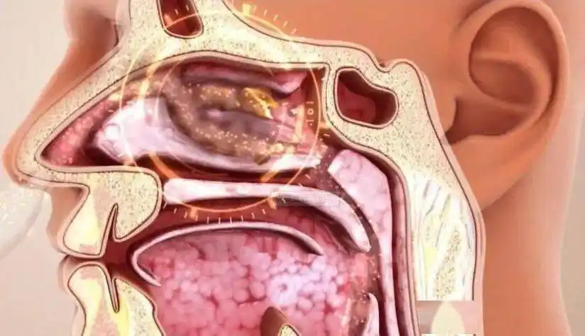 德国鼻炎界神器抑菌率高达995秒通鼻30秒杀菌止痒轻松缓解鼻炎
