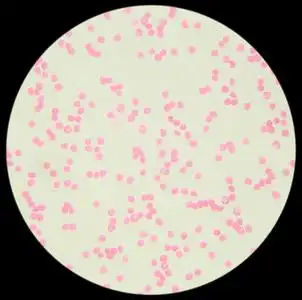 显微镜下的人体血液(血液涂片)照片