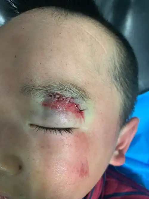 外伤整形美容缝合 - 好大夫在线