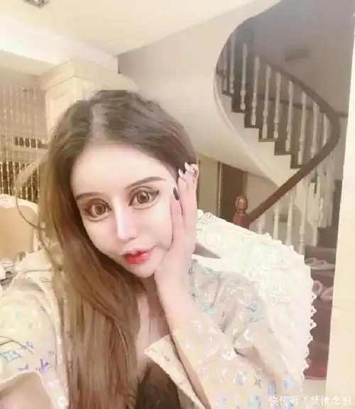 她13岁开始整容3年时间整容100次现在大变样真人蛇精