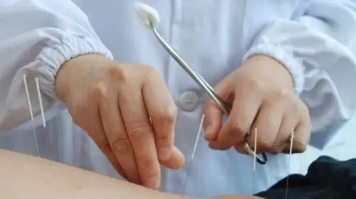 针灸治疗腰间盘突出的具体手法有哪些?怎么进行扎针呢?