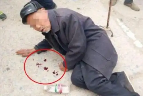 老人口吐鲜血倒地,医生一句话众人却对老人的行为不满!