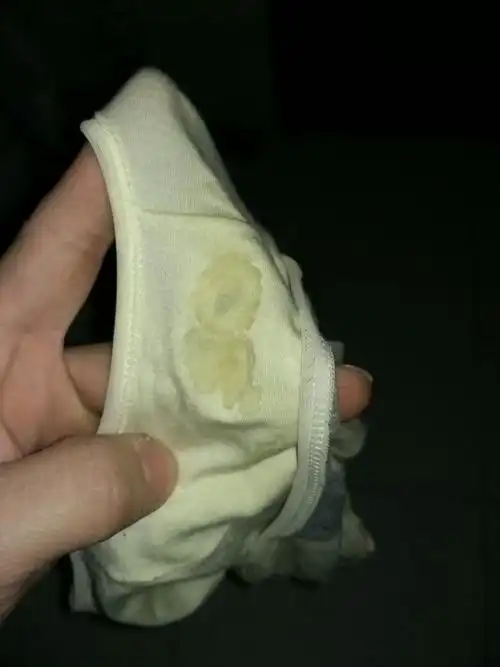 月经前,这是白带还是其他啥?