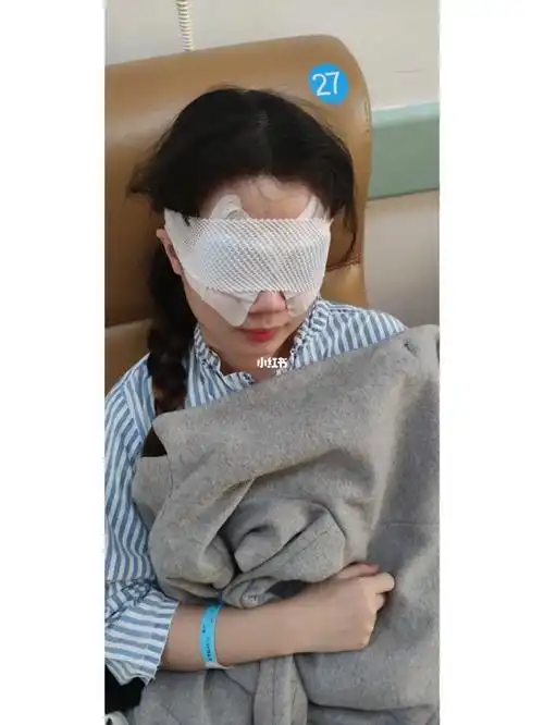 泪腺脱垂矫正术后第四天