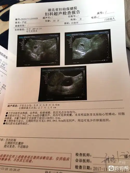 怀孕38天可以看到孕囊吗