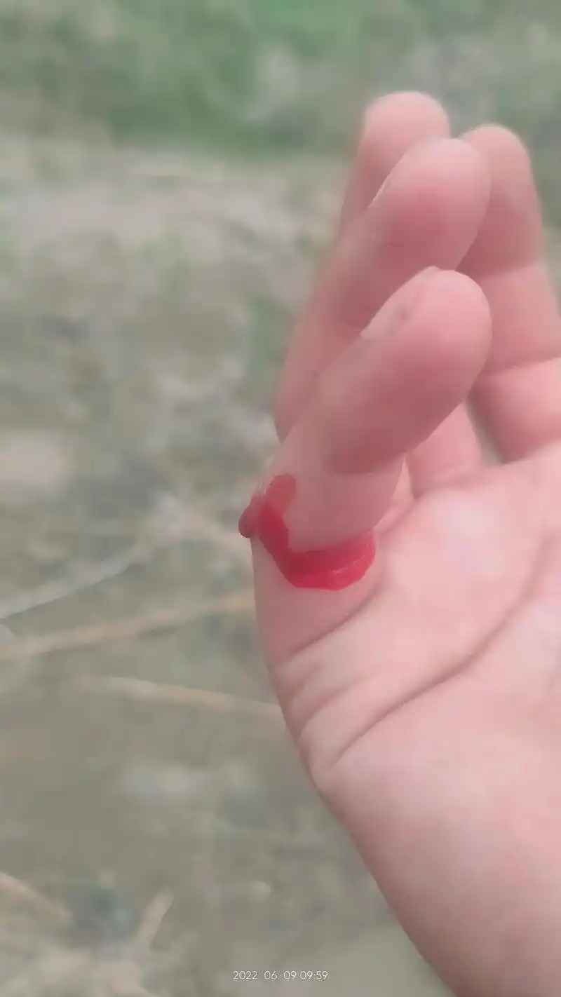 为什么我老是莫名其妙的被割伤,然后过好久发现手上有血才知道被 - 抖