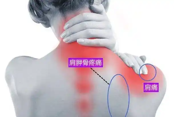 左后背肩胛骨附近疼痛,后背不同部位疼痛图