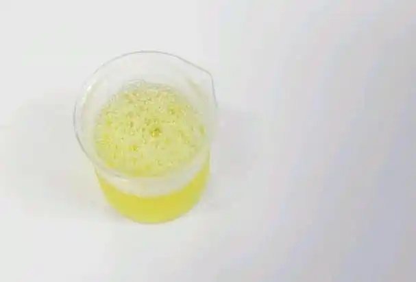 正常人淡黄色清澈透明的尿液