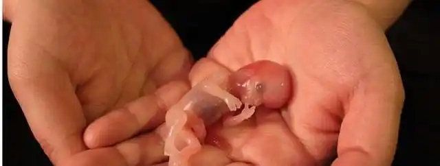 洗干净穿上为他准备的衣服,看着闭眼的宝宝不允许家人把这个宝宝下葬