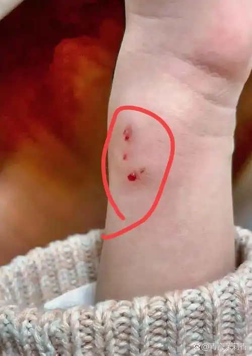 邻居家的孩子被我家狗子抓伤后,油盐不进的样子看得人直上火!