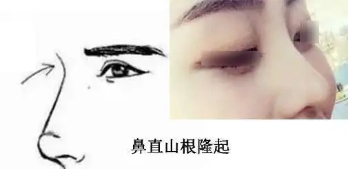 面相山根看婚姻山根左右夫妻座山根不断夫妻和