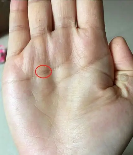 喝芡实茶别对咽炎有很明显的效果  好的,继续第四种 无名指下1线上有