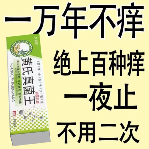 灰黄霉素疥疮灰黄霉素软膏甲癣抗真菌灰黄霉素头癣治头癣药膏外用