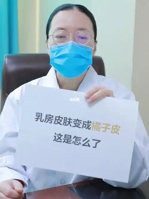 r房皮肤橘皮样改变最常见的就是乳腺ai