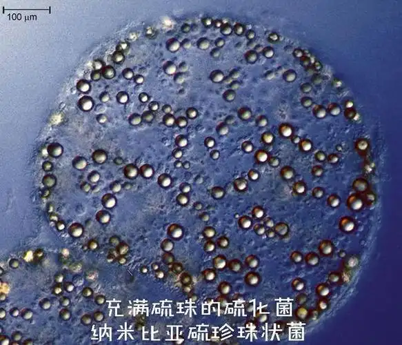 如果生物体内有一种可以生成硫化类物质的单细胞细菌或生物存活,比如