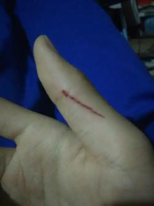 我刚刚用一把生锈的刀刮破了手,怎么办,要不要打破伤风,伤口大概有2