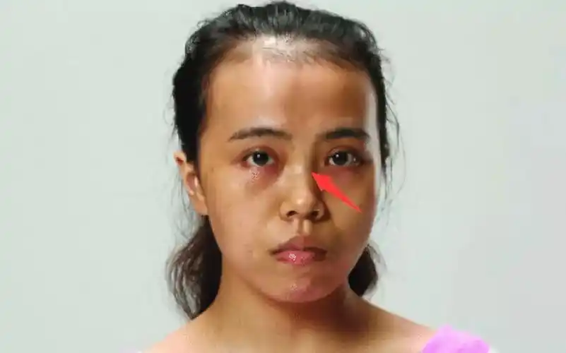 四种命苦的女人面相,收入少,靠苦力赚钱,儿孙不勤!