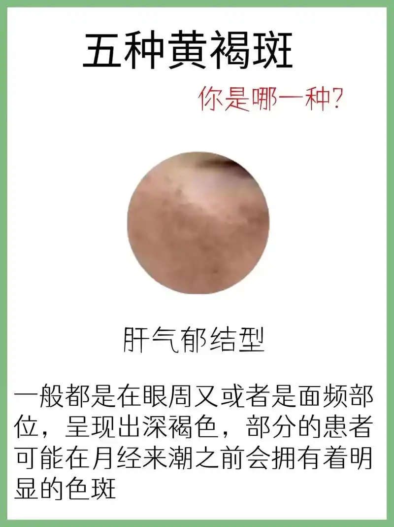 99.98夏天到了,阳光明 - 抖音