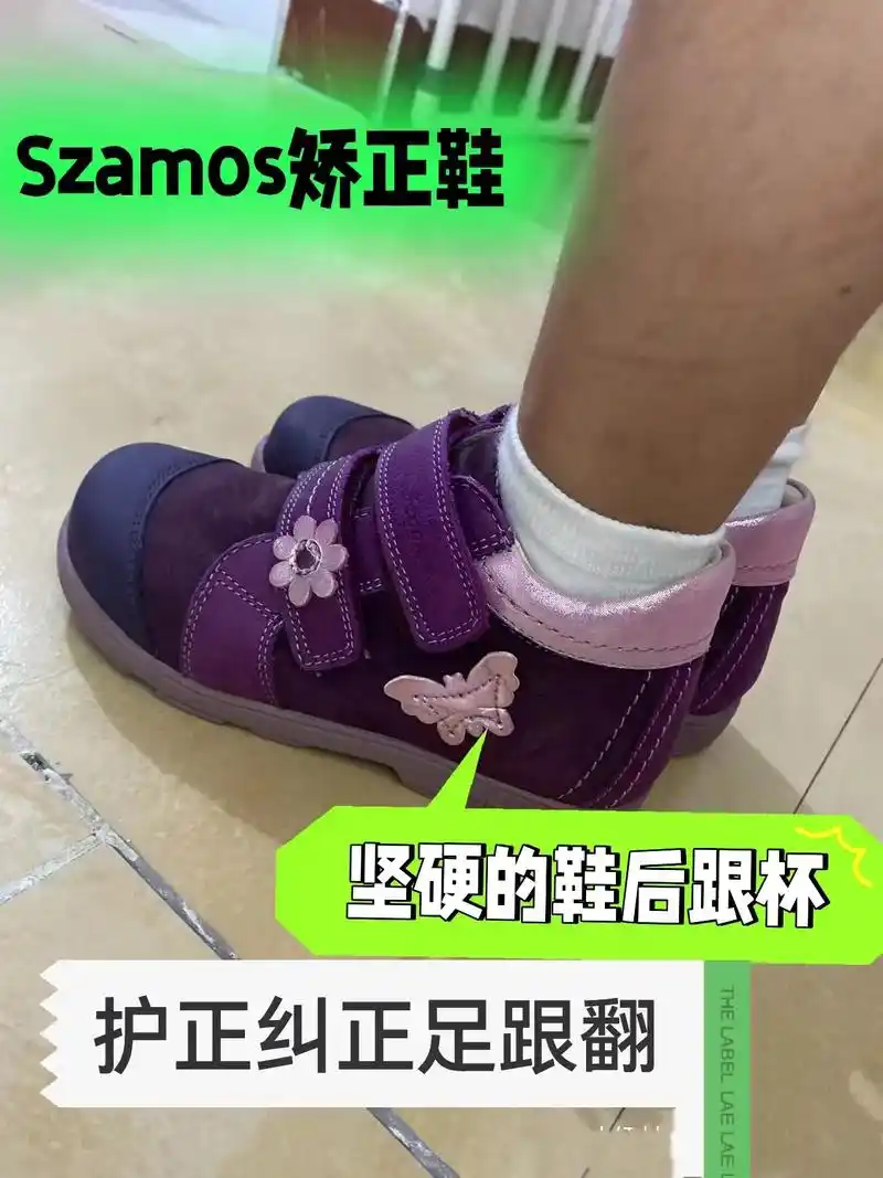 如何矫正【足外翻 扁平足 脚趾头拇外翻】9369♀15小女孩矫正